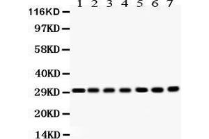 Western Blotting (WB) image for anti-Catechol-O-Methyltransferase (COMT) (AA 52-271) antibody (ABIN3043815) (COMT antibody  (AA 52-271))