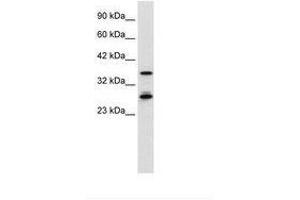 Image no. 1 for anti-Metal Response Element Binding Transcription Factor 2 (MTF2) (AA 26-75) antibody (ABIN6736029)