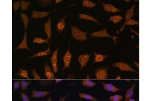 Immunofluorescence analysis of L929 cells using PDE6D Polyclonal Antibody at dilution of 1:100 (40x lens). (PDE6D antibody)