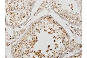 Immunoperoxidase of purified MaxPab antibody to DYX1C1 on formalin-fixed paraffin-embedded human testis.