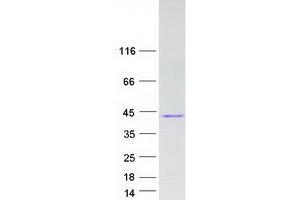 Western Blotting (WB) image for Activator of Basal Transcription 1 (Abt1) protein (Myc-DYKDDDDK Tag) (ABIN2714293)