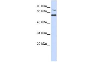 Western Blotting (WB) image for anti-POC1 Centriolar Protein Homolog B (POC1B) antibody (ABIN2459940) (POC1B antibody)