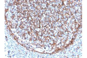 Formalin-fixed, paraffin-embedded human tonsil stained with CD11b Monospecific Mouse Monoclonal Antibody (ITGAM/3340). (CD11b antibody  (AA 941-1074))