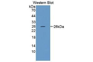 Western blot analysis of the recombinant protein. (FPGT antibody  (AA 314-513))