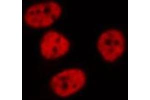 ABIN6268842 staining HeLa cells by IF/ICC.