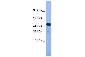 Western Blot showing Klhdc9 antibody used at a concentration of 1. (KLHDC9 antibody  (Middle Region))