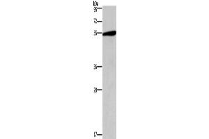 Western Blotting (WB) image for anti-5-Hydroxytryptamine (serotonin) Receptor 2C (HTR2C) antibody (ABIN2432627) (HTR2C antibody)