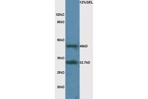Mouse brain lysate probed with Rabbit Anti-LAMR1 Polyclonal Antibody, Unconjugated  at 1:3000 for 90 min at 37˚C.