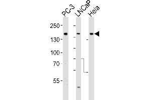Western blot analysis of lysates from PC-3, LNCaP, Hela cell line (from left to right), using Tuberin (TSC2) Antibody (ABIN390324 and ABIN2840755).