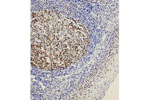 Anti-BOB1 antibody, IHC(P) IHC(P): Rat Tonsil Tissue