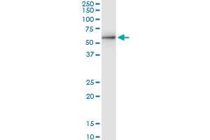 Immunoprecipitation of STK40 transfected lysate using anti-STK40 MaxPab rabbit polyclonal antibody and Protein A Magnetic Bead , and immunoblotted with STK40 purified MaxPab mouse polyclonal antibody (B01P) . (STK40 antibody  (AA 1-435))