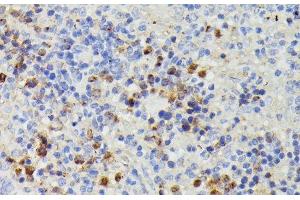 Immunohistochemistry of paraffin-embedded Rat spleen using DUT Polyclonal Antibody at dilution of 1:100 (40x lens). (Deoxyuridine Triphosphatase (DUT) antibody)