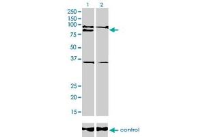 Western Blotting (WB) image for anti-Ring Finger Protein 141 (RNF141) (AA 141-230) antibody (ABIN599236) (RNF141 antibody  (AA 141-230))