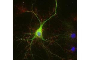 Indirect immunostaining of methanol fixed rat hippocampus neurons with anti-ADAM 22 (dilution 1 : 500; red) and mouse anti-MAP 2 (, dilution 1 : 1000; green). (ADAM22 antibody  (AA 775-905))