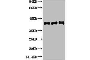 Western blot analysis of 1) Hela, 2) Mouse Brain tissue, 3) Rat Brain tissue, diluted at 1:20000.