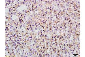 PTGER1 antibody  (AA 61-160)