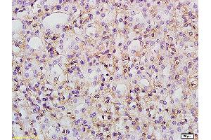 Formalin-fixed and paraffin embedded rat kidney labeled with Anti PTGER1/EP1 Polyclonal Antibody, Unconjugated at 1:200 followed by conjugation to the secondary antibody and DAB staining (PTGER1 antibody  (AA 61-160))