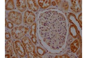 IHC image of ABIN7127803 diluted at 1:100 and staining in paraffin-embedded human kidney tissue performed on a Leica BondTM system. (Recombinant SDHB antibody)