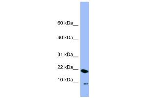 WB Suggested Anti-PIN4 Antibody Titration: 0. (PIN4 antibody  (N-Term))