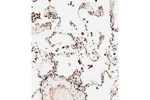 Immunohistochemical analysis of paraffin-embedded human lung tissue using B performed on the Leica® BOND RXm. (STRA8 antibody  (C-Term))