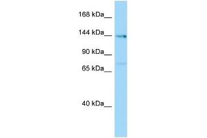 Host:  Rabbit  Target Name:  Plekha6  Sample Type:  Rat Testis lysates  Antibody Dilution:  1.