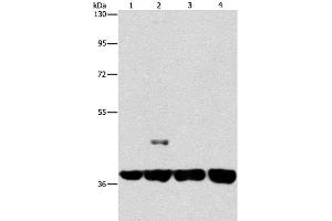 Western Blot analysis of 293T and 231 cell, U937 and Raji cell using SERPINA9 Polyclonal Antibody at dilution of 1:350 (SERPINA9 antibody)