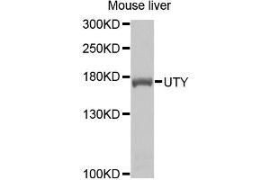 Western blot analysis of extracts of mouse liver cells, using UTY antibody. (UTY antibody)