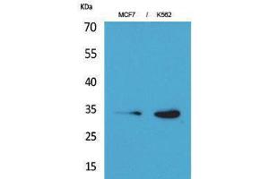 Western Blotting (WB) image for anti-Cyclin-Dependent Kinase 4 (CDK4) (N-Term) antibody (ABIN3178229) (CDK4 antibody  (N-Term))
