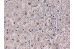 Immunohistochemistry (IHC) image for anti-Interleukin 5 (IL5) (AA 20-134) antibody (ABIN7430837)