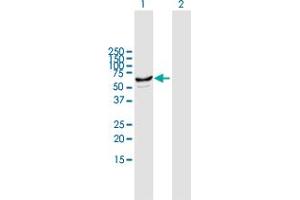 Western Blot analysis of CYP2J2 expression in transfected 293T cell line by CYP2J2 MaxPab polyclonal antibody.
