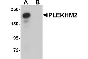 Western Blotting (WB) image for anti-Pleckstrin Homology Domain Containing, Family M (With RUN Domain) Member 2 (PLEKHM2) (C-Term) antibody (ABIN1030591) (PLEKHM2 antibody  (C-Term))