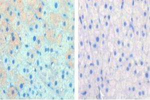 Left image is paraformaldehyde-fixed and paraffin-embedded cow lactating with CPT1A Pab (ABIN389101 and ABIN2839291) , which was peroxidase-conjugated to the secondary antibody, followed by AEC staining, right image is contrast, did not add the antibody. (CPT1A antibody  (C-Term))