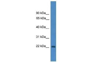 OTUB2 antibody used at 0. (OTUB2 antibody  (N-Term))