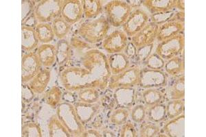 Immunohistochemical staining of human renal cancer tissue section with AHSG monoclonal antibody, clone 20  at 1:100 dilution. (Fetuin A antibody  (AA 19-367))