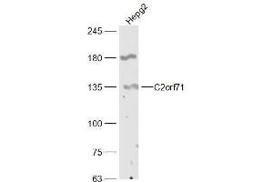 HepG2 lysates probed with C2orf71 Polyclonal Antibody, Unconjugated  at 1:300 dilution and 4˚C overnight incubation. (C2orf71 antibody  (AA 701-800))