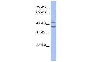 SERPINB2 antibody used at 1 ug/ml to detect target protein.