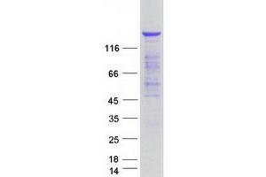 Validation with Western Blot (TBC1D1 Protein (Myc-DYKDDDDK Tag))