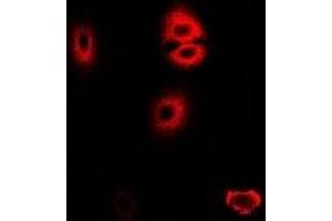 Immunofluorescent analysis of HADHA staining in U2OS cells. (HADHA antibody)
