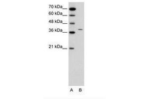Image no. 1 for anti-Receptor-Associated Protein of The Synapse (RAPSN) (N-Term) antibody (ABIN6736649) (RAPSN antibody  (N-Term))
