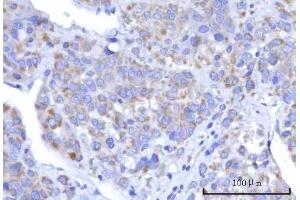IHC analysis of C18orf22/RBFA using anti-C18orf22/RBFA antibody (ABIN7600106).