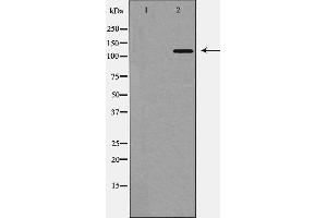 Western blot analysis of TYK2 expression in 293 cell,The lane on the left is treated with the antigen-specific peptide. (TYK2 antibody  (C-Term))