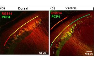 Representative images of RGS14 and PCP4 immunofluorescence. (RGS14 antibody  (AA 1-544))