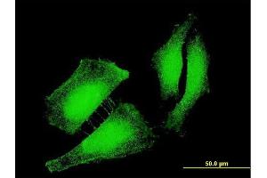 Immunofluorescence of monoclonal antibody to FOXO3 on HeLa cell. (FOXO3 antibody  (AA 361-460))