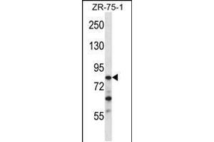 Western blot analysis in ZR-75-1 cell line lysates (35ug/lane). (CNOT3 antibody  (N-Term))