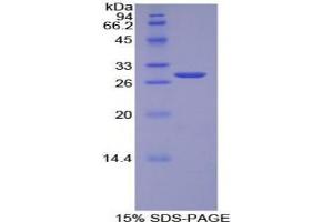 SDS-PAGE analysis of Human TOR1AIP2 Protein.
