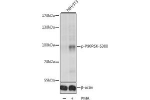 Western blot analysis of extracts of various cell lines, using Phospho-p90Rsk/RSK1/RPS6K-S380 antibody (ABIN6135275, ABIN6136172, ABIN6136173 and ABIN6225586) at 1:1000 dilution. (RPS6KA1 antibody  (pSer380))