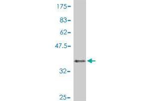 Western Blot detection against Immunogen (37. (BCCIP antibody  (AA 210-314))