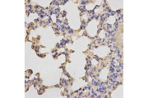 Immunohistochemistry (IHC) image for anti-Protein Kinase, CAMP Dependent, Catalytic, beta (PRKACB) antibody (ABIN1876512) (PRKACB antibody)