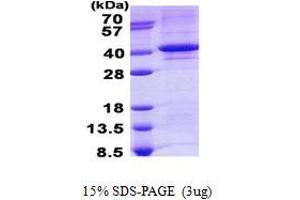 Image no. 1 for Tyrosyl-DNA Phosphodiesterase 1 (TDP1) protein (His tag) (ABIN1098766)