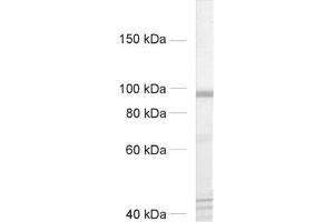 dilution: 1 : 500, sample: rat brain homogenate (CASK antibody  (AA 1-337, AA 318-415))